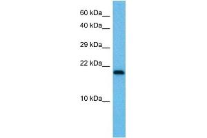 Host:  Mouse  Target Name:  UBE2I  Sample Tissue:  Mouse Testis  Antibody Dilution:  1ug/ml (UBE2I antibody  (N-Term))