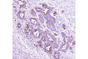 IHC analysis of TANK using anti-TANK antibody (ABIN6719508). (TANK antibody)