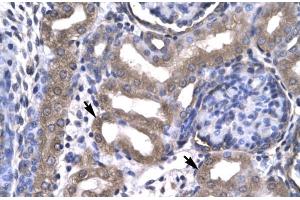 Human kidney; KIN antibody - middle region in Human kidney cells using Immunohistochemistry