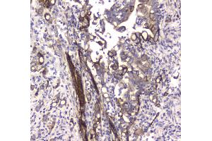 Immunohistochemistry (IHC) image for anti-Microtubule-Associated Protein 1 Light Chain 3 alpha (MAP1LC3A) (AA 1-120) antibody (ABIN5693061)