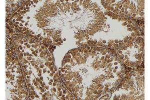 ABIN6277106 at 1/100 staining Mouse testis tissue by IHC-P. (SYK antibody)