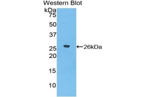 EPYC antibody  (AA 110-317)