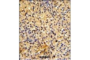 Formalin-fixed and paraffin-embedded human spleen tissue reacted with LY75 Antibody (Center), which was peroxidase-conjugated to the secondary antibody, followed by DAB staining. (LY75/DEC-205 antibody  (AA 646-675))