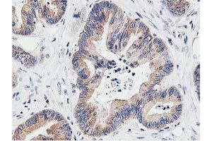 Image no. 10 for anti-Leucine Carboxyl Methyltransferase 1 (LCMT1) antibody (ABIN1499107) (LCMT1 antibody)