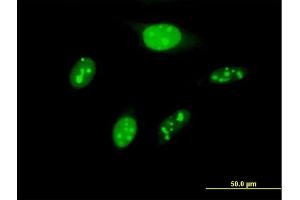 Immunofluorescence of purified MaxPab antibody to BYSL on HeLa cell. (Bystin-Like antibody  (AA 1-437))