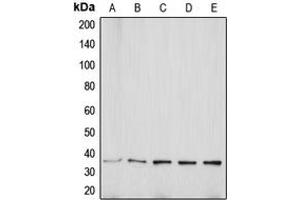 Western blot analysis of Aquaporin 5 expression in MCF7 (A), Jurkat (B), SP2/0 (C), PC12 (D), KNRK (E) whole cell lysates. (Aquaporin 5 antibody  (C-Term))