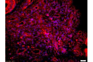 Formalin-fixed and paraffin embedded Human endometrium labeled with Anti-phospho-Tau protein(Ser396) Polyclonal Antibody, Unconjugated (ABIN746453) at 1:200 followed by conjugation to the secondary antibody Goat Anti-Rabbit IgG, Cy3 conjugated used at 1:200 dilution for 40 minutes at 37°C and DAPI staining (tau antibody  (pSer396))