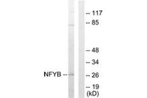 Western blot analysis of extracts from 293 cells, using NFYB Antibody.