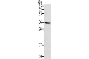 Gel: 8 % SDS-PAGE, Lysate: 40 μg, Lane: Human normal liver tissue, Primary antibody: ABIN7131123(SNX11 Antibody) at dilution 1/300, Secondary antibody: Goat anti rabbit IgG at 1/8000 dilution, Exposure time: 5 minutes
