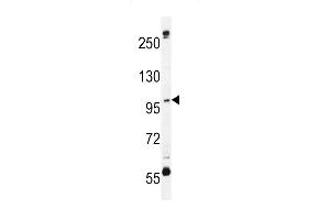 C Antibody (N-term) (ABIN654933 and ABIN2844576) western blot analysis in MDA-M cell line lysates (35 μg/lane). (SWT1 antibody  (N-Term))