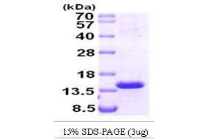 Figure annotation denotes ug of protein loaded and % gel used. (TCL1A Protein (AA 1-114))