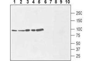 Western blot analysis of rat brain membranes (lanes 1 and 6), mouse brain lysate (lanes 2 and 7), human MCF-7 breast adenocarcinoma cells (lanes 3 and 8), human U-87 MG glioblastoma cells (lanes 4 and 9) and human THP-1 acute monocytic leukemia cells (lanes 5 and 10): - 1-5. (SLC9A1 antibody  (1st Extracellular Loop))