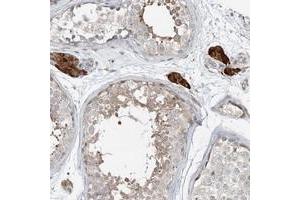 Immunohistochemical staining of human testis with CXXC5 polyclonal antibody  shows strong cytoplasmic positivity in Leydig cells.