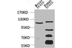 Western blot analysis of 1) Mouse Brain Tissue, 2)Human Brain Tissue, with CaVα2δ3 Rabbit pAb diluted at 1:2,000. (CACNA2D3 antibody)