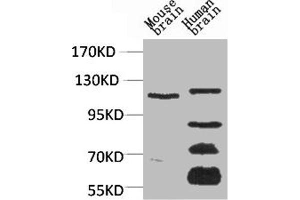 CACNA2D3 antibody