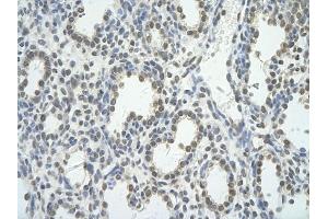 Rabbit Anti-BRD7 antibody         Paraffin Embedded Tissue:  Human Lung    cell Cellular Data:  alveolar cell    Antibody Concentration:  4. (BRD7 antibody  (C-Term))