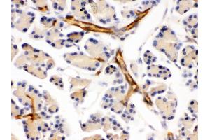 Immunohistochemistry (Paraffin-embedded Sections) (IHC (p)) image for anti-Protein Phosphatase 1, Regulatory (Inhibitor) Subunit 1B (PPP1R1B) (AA 1-36), (N-Term) antibody (ABIN3044534)
