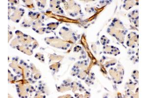 DARPP32 was detected in paraffin-embedded sections of mouse pancreas tissues using rabbit anti- DARPP32 Antigen Affinity purified polyclonal antibody at 1 μg/mL.