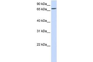 WB Suggested Anti-IL1RAPL2 Antibody Titration:  0. (IL1RAPL2 antibody  (Middle Region))