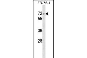 ZKSCAN1 Antibody (Center) (ABIN1538154 and ABIN2848860) western blot analysis in ZR-75-1 cell line lysates (35 μg/lane). (ZKSCAN1 antibody  (AA 238-265))