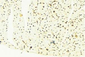 ABIN6276361 at 1/100 staining Mouse liver tissue by IHC-P.
