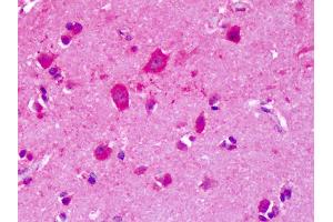 Anti-GRM8 / MGLUR8 antibody IHC of human brain, cortex. (GRM8 antibody  (N-Term))
