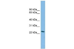 WB Suggested Anti-SSX4B Antibody Titration: 0. (SSX4B antibody  (Middle Region))