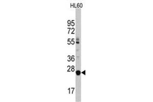 Image no. 1 for anti-Lin-28 Homolog B (LIN28B) (C-Term) antibody (ABIN357012) (LIN28B antibody  (C-Term))