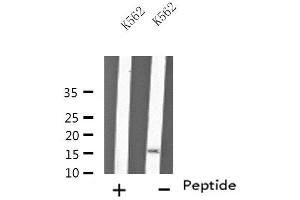 Western blot analysis of extracts from K562 cells, using MYL6 antibody. (MYL6 antibody  (Internal Region))