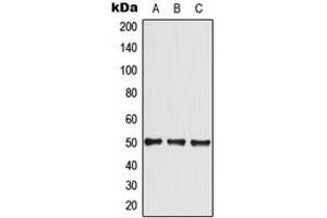 Western blot analysis of GLUT4 expression in A549 (A), HeLa (B), NIH3T3 (C) whole cell lysates. (GLUT4 antibody  (Center))