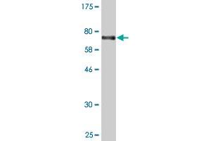 Western Blot detection against Immunogen (69. (PUS1 antibody  (AA 1-399))