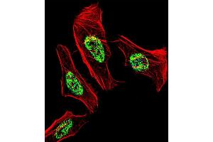 Fluorescent confocal image of Hela cell stained with NR2C2 Antibody (C-term) (ABIN1537335 and ABIN2838328).