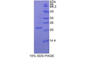 SDS-PAGE (SDS) image for Nitric Oxide Synthase 3 (Endothelial Cell) (NOS3) (AA 522-705) protein (His tag) (ABIN2121781)