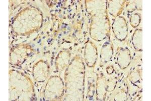Immunohistochemistry of paraffin-embedded human stomach tissue using ABIN7152265 at dilution of 1:100