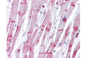 Anti-ACTN2 antibody IHC of human heart. (ACTN2 antibody  (AA 11-347))