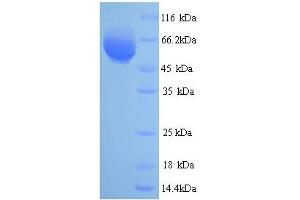 SDS-PAGE (SDS) image for Ret Oncogene (RET) (AA 24-538) protein (His tag) (ABIN5714120) (Ret Oncogene Protein (RET) (AA 24-538) (His tag))