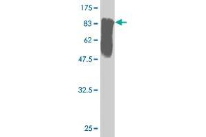 Western Blot detection against Immunogen (82. (STK33 antibody  (AA 1-514))