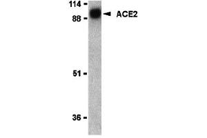 Western Blotting (WB) image for anti-Angiotensin I Converting Enzyme 2 (ACE2) (N-Term) antibody (ABIN1031210) (ACE2 antibody  (N-Term))