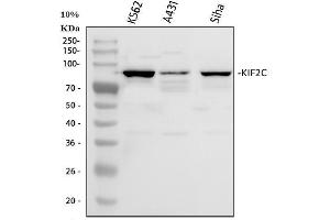 Western blot analysis of MCAK using anti-MCAK antibody (ABIN3043278). (KIF2C antibody  (AA 531-725))
