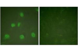 Immunofluorescence analysis of HeLa cells, using Cullin 1 Antibody. (Cullin 1 antibody  (AA 727-776))