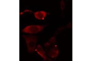 ABIN6277002 staining Hela cells by IF/ICC. (TBXAS1 antibody  (N-Term))