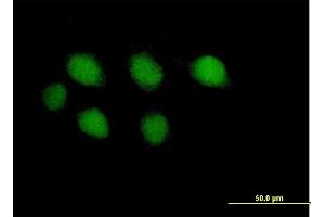 Immunofluorescence of purified MaxPab antibody to POLE on HeLa cell.