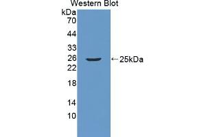 Detection of Recombinant RGS5, Mouse using Polyclonal Antibody to Regulator Of G Protein Signaling 5 (RGS5) (RGS5 antibody  (AA 1-181))