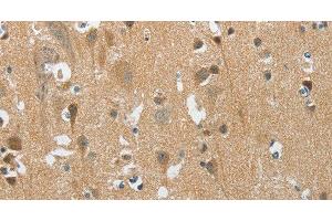 Immunohistochemistry of paraffin-embedded Human brain tissue using PITX3 Polyclonal Antibody at dilution 1:40 (PITX3 antibody)