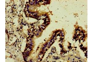 Immunohistochemistry of paraffin-embedded human lung tissue using ABIN7148789 at dilution of 1:100 (ATF3 antibody  (AA 1-181))