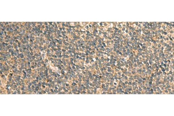 GC-Rich Promoter Binding Protein 1 (GPBP1) antibody