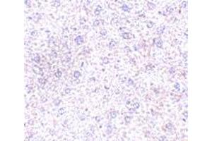 Immunohistochemistry of PLXDC1 in mouse liver tissue with PLXDC1 polyclonal antibody  at 2.