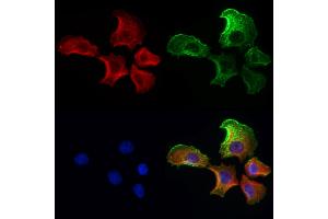 ABIN6259812 and ABIN6272986 staining Hela cells by IF/ICC. (ADRM1 antibody  (Internal Region))