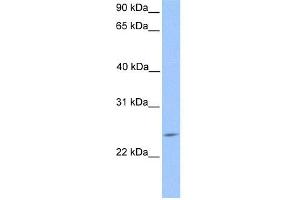 WB Suggested Anti-PTTG2 Antibody Titration:  0. (PTTG2 antibody  (Middle Region))