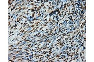 Immunohistochemical staining of paraffin-embedded liver tissue using anti-PSMC3 mouse monoclonal antibody.